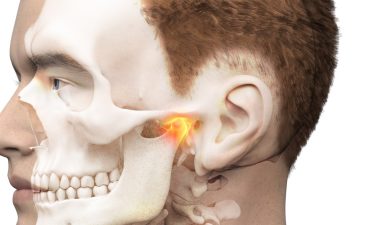 턱관절 약물치료와 보톡스 효과, 치과 구강내과의 접근 | 이선희 원장 썸네일 이미지